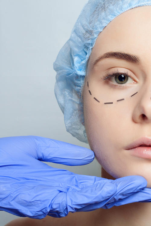 Göz Kapağı Ameliyatları ve Estetiği (Oküloplasti)